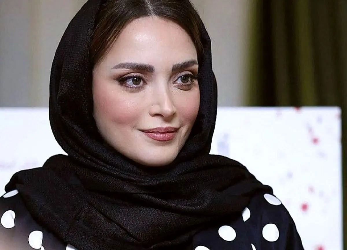 چهره باورنکردنی و زشت بهنوش طباطبایی| خانم بازیگر یک شبه زشت شد