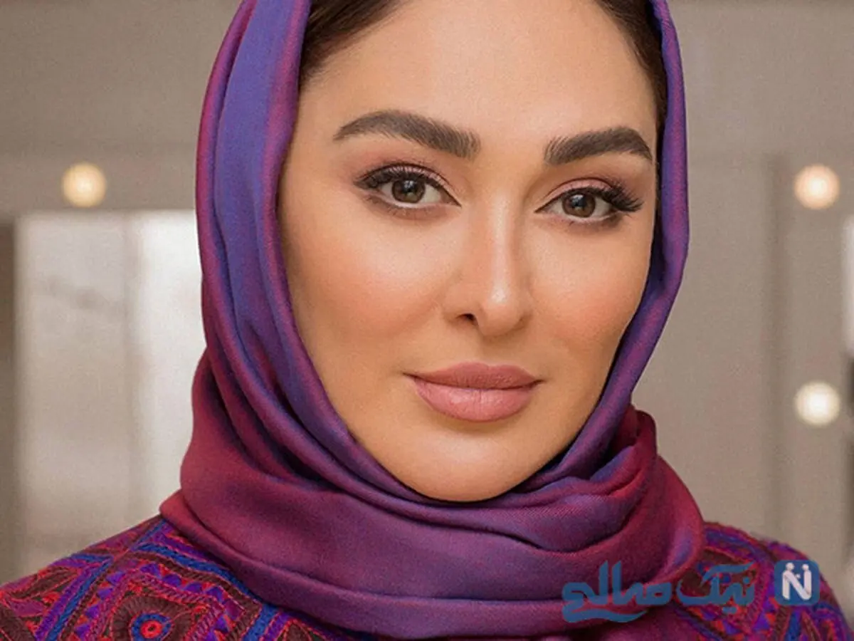 عکس زیر خاکی از الهام حمیدی قبل از عمل | الهام حمیدی ترکونده!