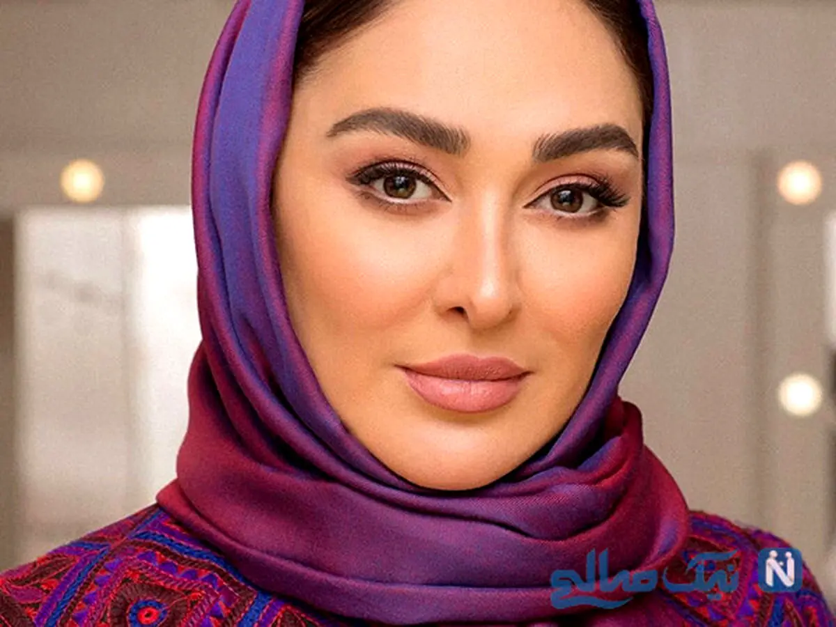 الهام حمیدی باز زیر تیغ جراحی رفت | عمل زیبایی ابرو الهام حمیدی  رو یه جوون 20 ساله کرد!