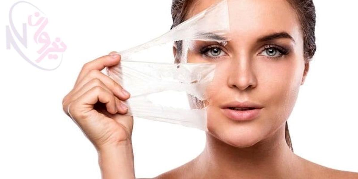 روش های لایه برداری پوست | بهترین تکنیک لایره برداری صورت