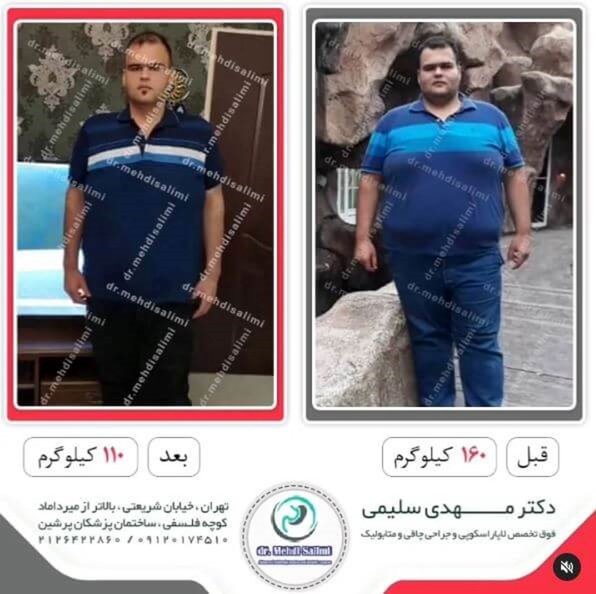 هزینه جراحی معده