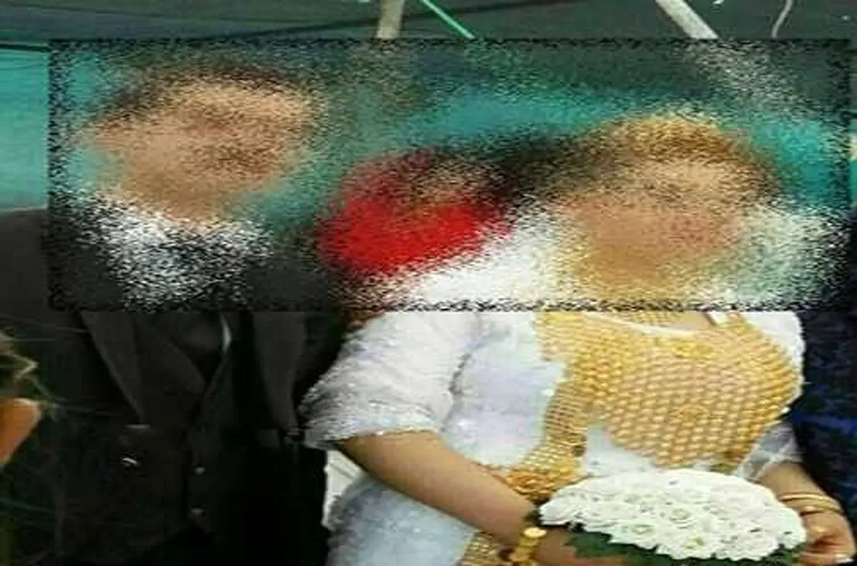 داماد بی رحم پای نوعروس را قطع کرد!