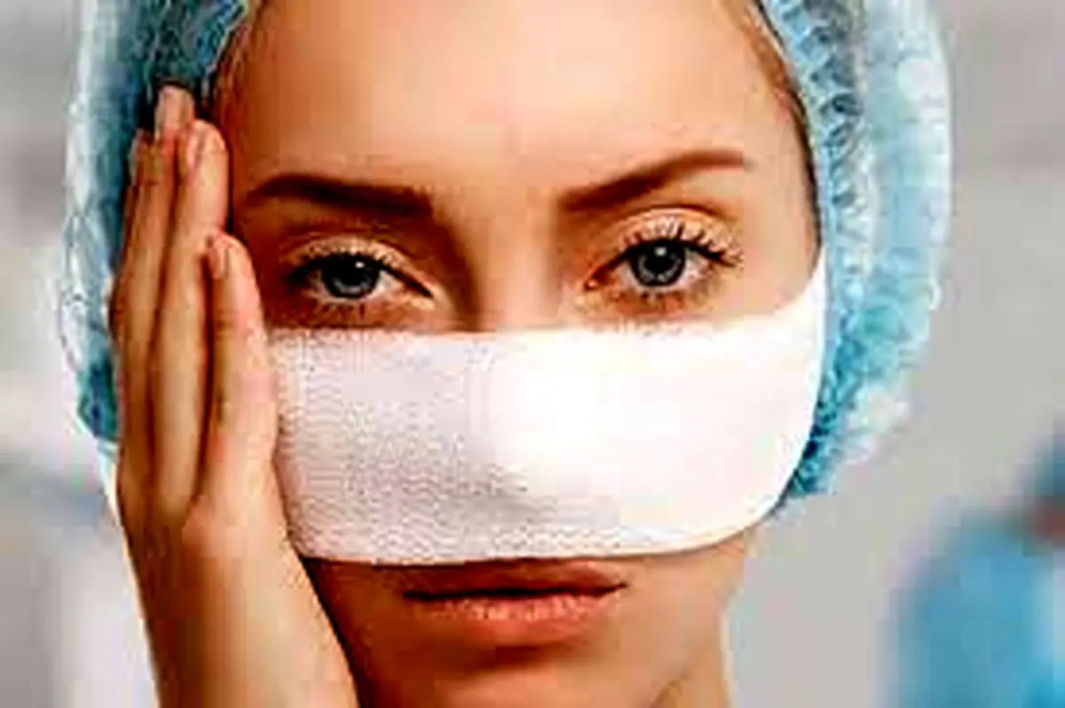 رینوپلاستی و مراقبت های بعد جراحی