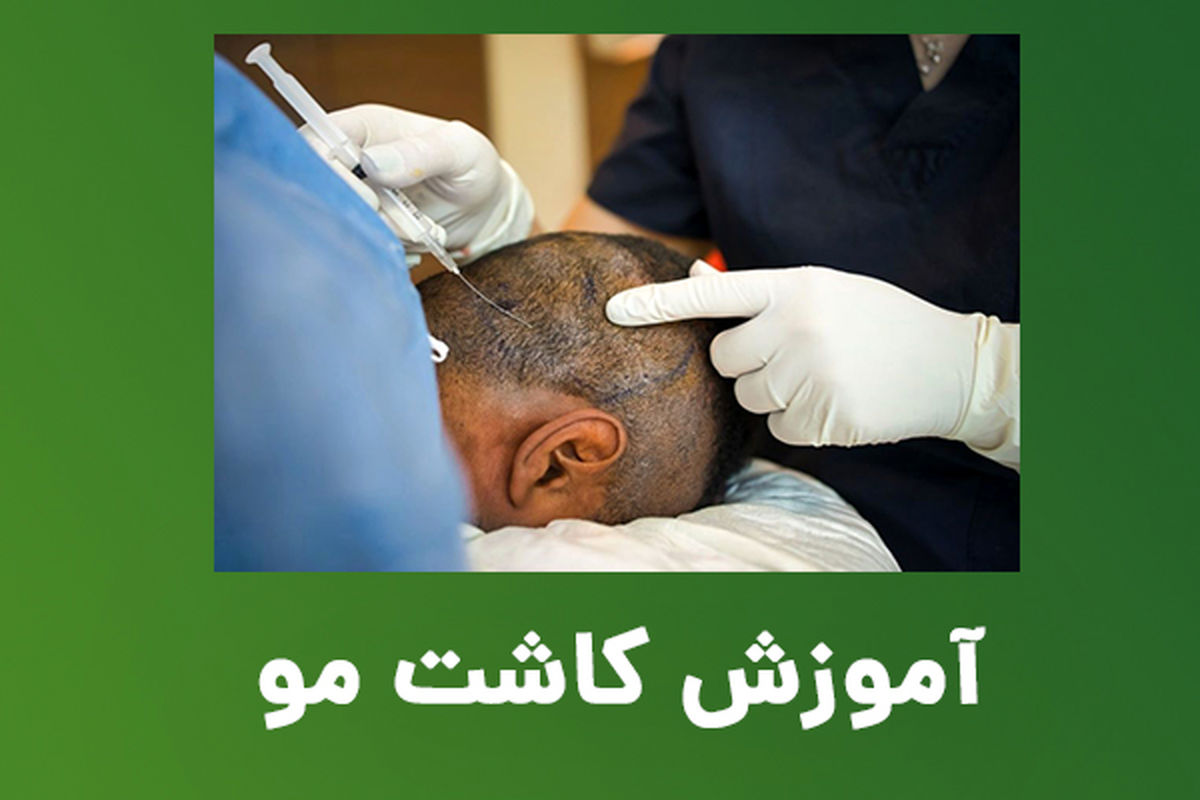 آموزش کاشت مو؛ فرصتی برای افزایش درآمد و ارتقا شغلی