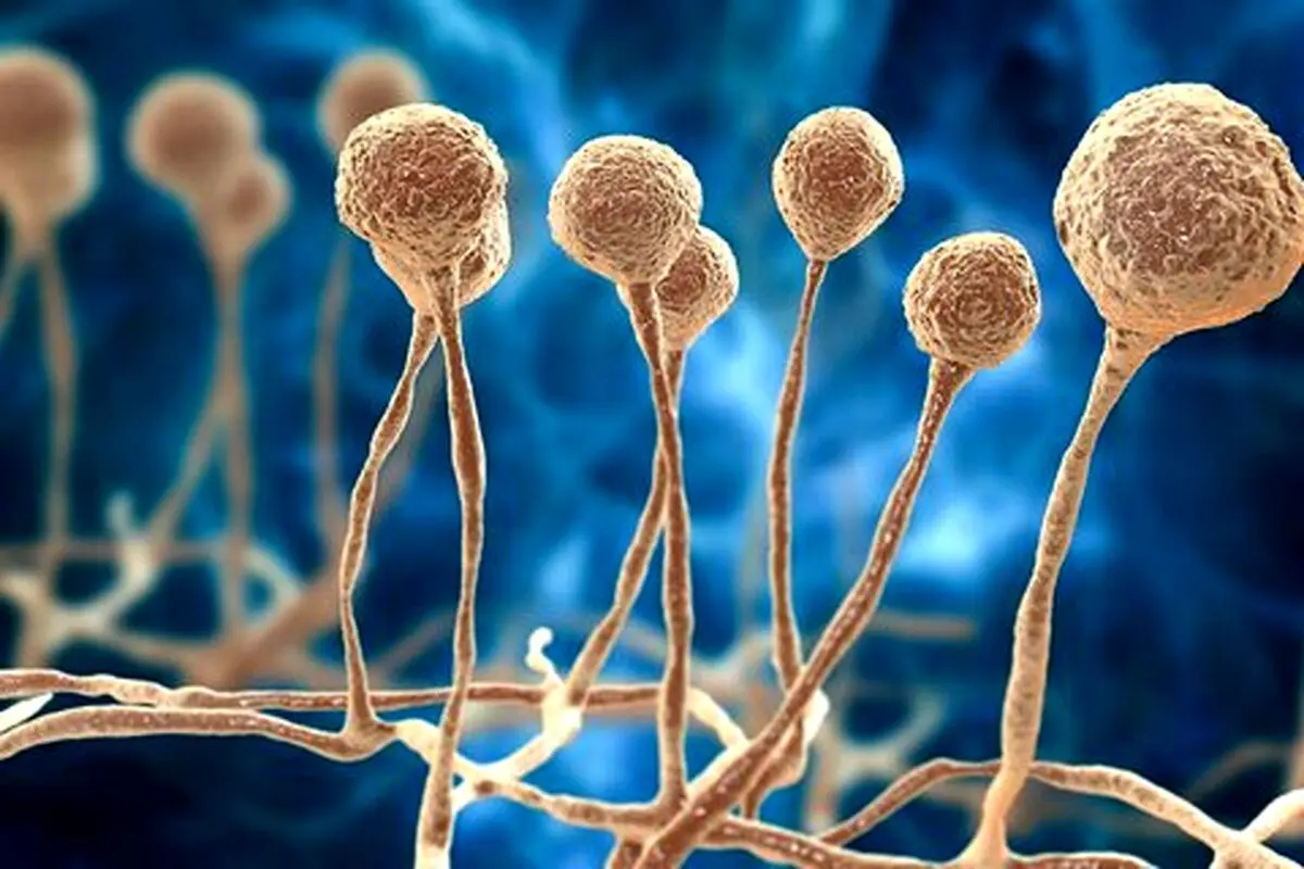 نشانه های قارچ سیاه را بشناسید | آمار ابتلا به قارچ سیاه باورنکردنی شد