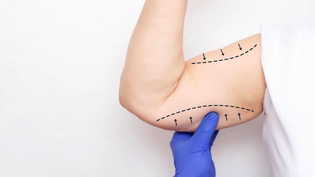 لیپوماتیک بازو چگونه انجام می شود؟